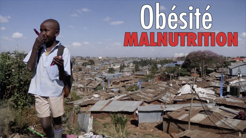 Afrique : Quand la malnutrition côtoie le surpoids