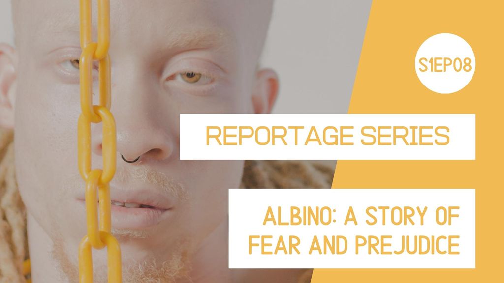 Reportage series - Albino: A Story of Fear and Prejudice